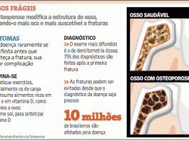 A OSTEOPOROSE: CAUSAS, SINTOMAS E TRATAMENTO