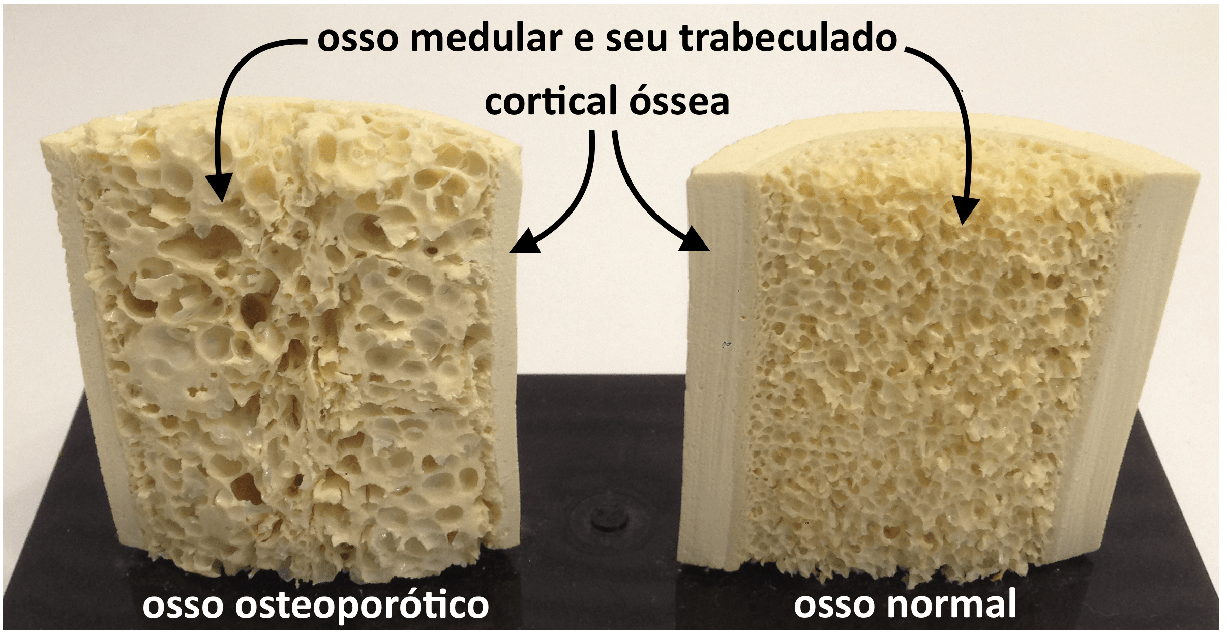 Exemplo De Hipote Para Anatonomia Humana Desenvlvimento Da Estrutura Ossea